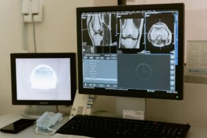 Pattern Recognition in MedTech